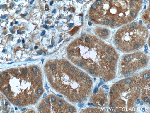 [66284-1-IG-20UL] SDCCAG8 Monoclonal antibody