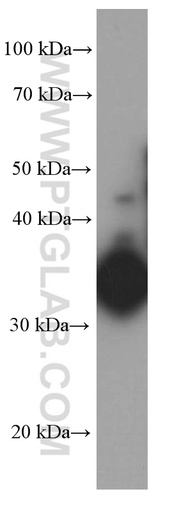 [66288-1-IG-150UL] IL-12B Monoclonal antibody