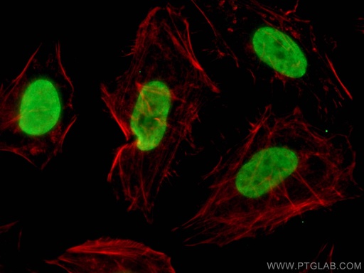 [66289-1-IG-150UL] Pan Acetylation Monoclonal antibody
