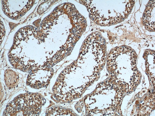 [66291-1-IG-150UL] HSPA2 Monoclonal antibody
