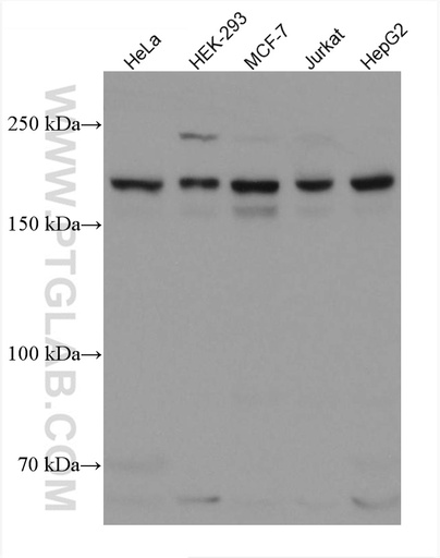 [66293-1-IG-20UL] SETDB1 Monoclonal antibody