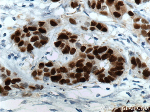 [66300-1-IG-20UL] PR Monoclonal antibody
