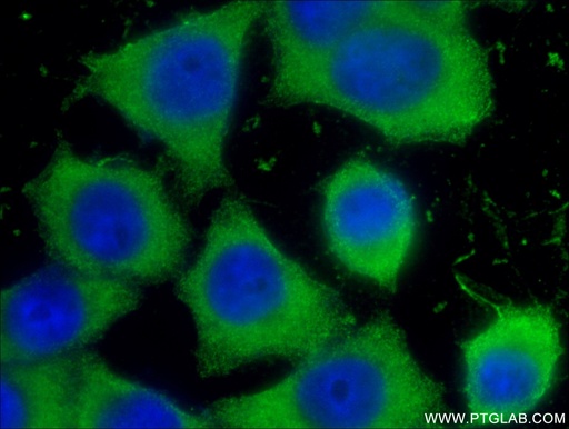 [66303-1-IG-20UL] LIPH Monoclonal antibody