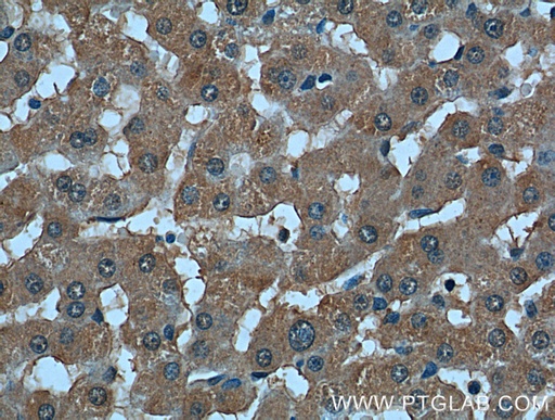 [66307-1-IG-150UL] TBL2 Monoclonal antibody