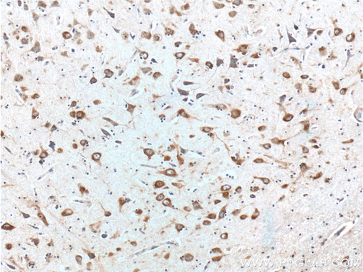 [66317-1-IG-150UL] Peripherin Monoclonal antibody