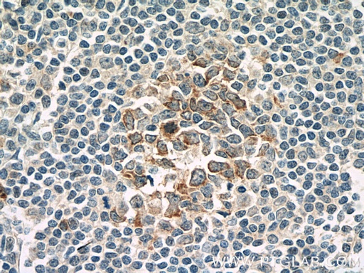 [66319-1-IG-20UL] IL-21R Monoclonal antibody