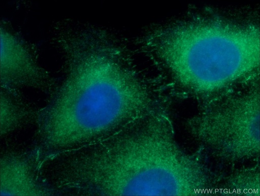 [66321-1-IG-20UL] Fascin Monoclonal antibody