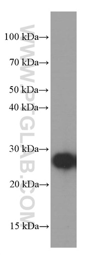 [66322-1-IG-150UL] GAMT Monoclonal antibody