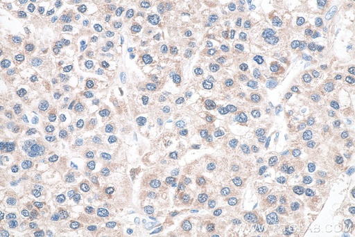 [66323-2-IG-150UL] Glutamine Synthetase Monoclonal antibody