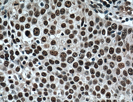 [66324-1-IG-20UL] TRIM24 Monoclonal antibody