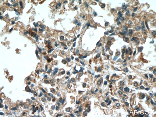[66326-1-IG-20UL] 5 Lipoxygenase Monoclonal antibody