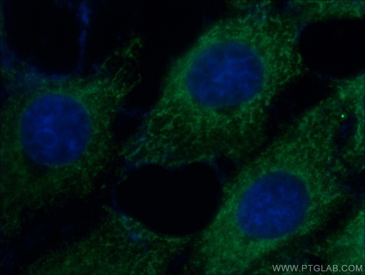 [66328-1-IG-150UL] SFRP2 Monoclonal antibody