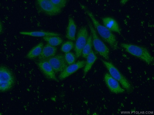 [66329-1-IG-150UL] SRD5A1 Monoclonal antibody