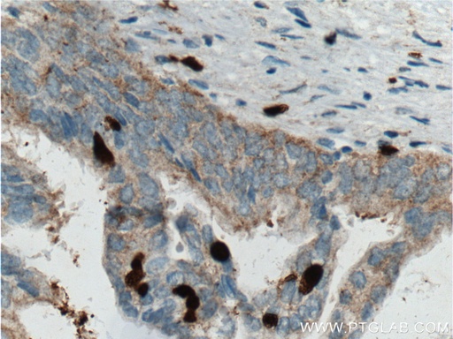 [66330-1-IG-150UL] SMYD3 Monoclonal antibody