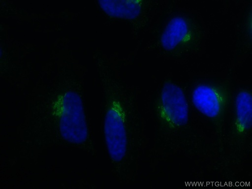 [66331-1-IG-20UL] GP73/GOLPH2 Monoclonal antibody
