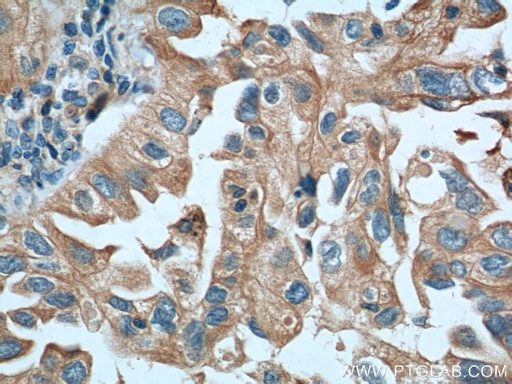 [66333-1-IG-20UL] IGSF2 Monoclonal antibody