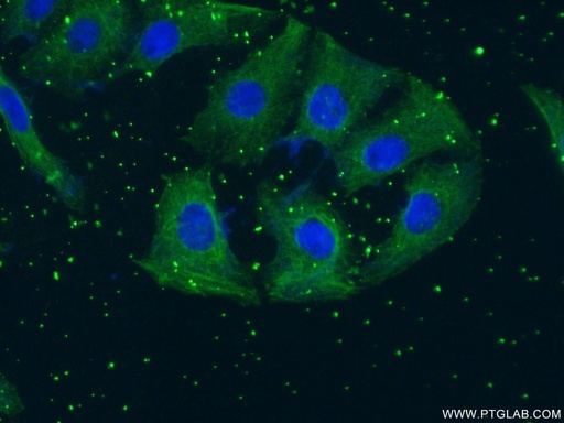 [66334-1-IG-150UL] TH Monoclonal antibody