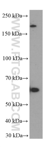 [66337-1-IG-150UL] FOXN1 Monoclonal antibody