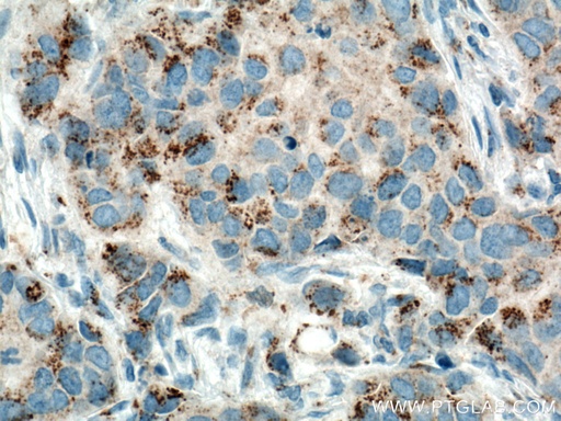 [66338-1-IG-20UL] MMP3 Monoclonal antibody
