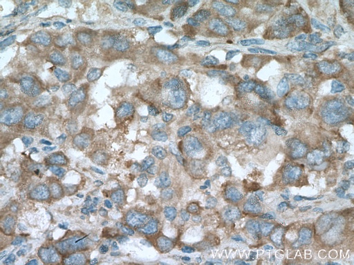 [66342-1-IG-150UL] PLOD2 Monoclonal antibody