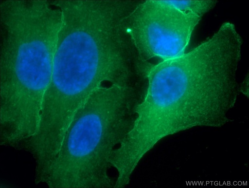 [66344-1-IG-150UL] Annexin A1 Monoclonal antibody