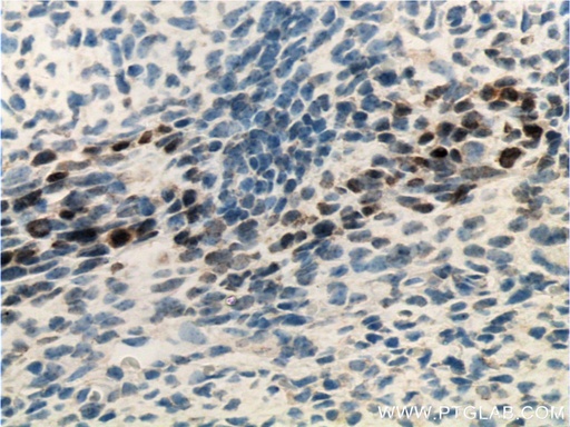 [66347-1-IG-20UL] SIX2 Monoclonal antibody