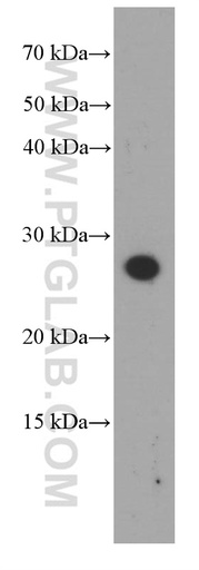 [66348-1-IG-20UL] Dermatopontin Monoclonal antibody