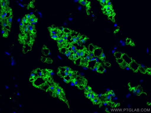 [66351-1-IG-20UL] COX2/ Cyclooxygenase 2/ PTGS2 Monoclonal antibody