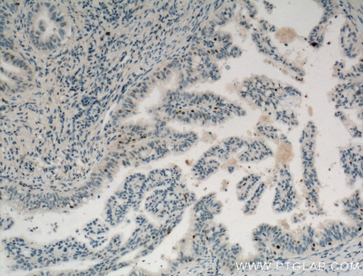 [66357-1-IG-150UL] Cyclin D3 Monoclonal antibody