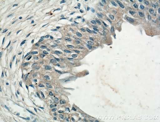 [66363-1-IG-150UL] CHRNA5 Monoclonal antibody