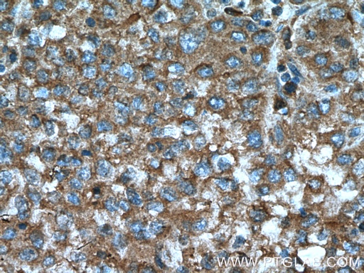 [66364-1-IG-150UL] D2HGDH Monoclonal antibody