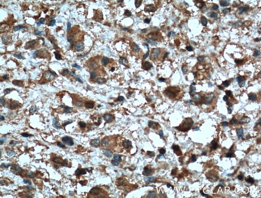[66366-1-IG-20UL] MMP2 Monoclonal antibody