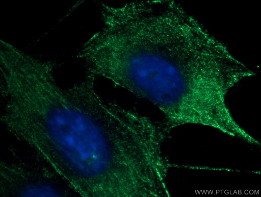 [66367-1-IG-150UL] SKAP2 Monoclonal antibody