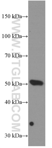 [66370-1-IG-20UL] BMP5 Monoclonal antibody