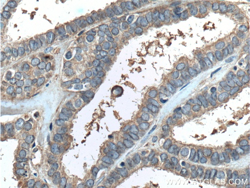 [66372-1-IG-150UL] PGRMC1 Monoclonal antibody