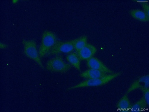 [66373-1-IG-20UL] G6PD Monoclonal antibody