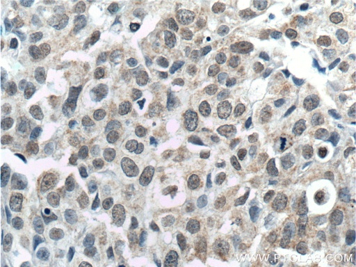 [66374-1-IG-20UL] TINP1 Monoclonal antibody