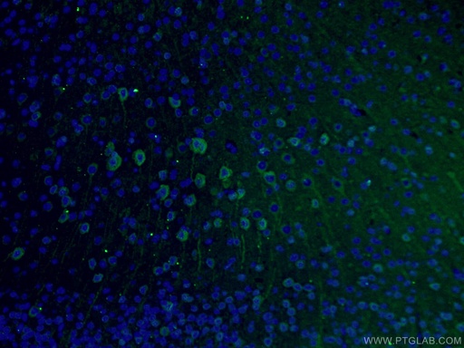 [66375-1-IG-150UL] TUBB3-specific Monoclonal antibody