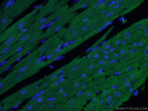 [66376-1-IG-150UL] Cardiac Troponin I Monoclonal antibody