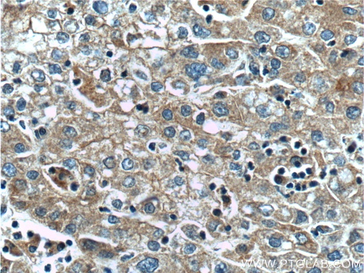 [66381-1-IG-20UL] SLCO1B3 Monoclonal antibody
