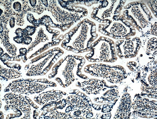 [66383-1-IG-150UL] BMP2 Monoclonal antibody