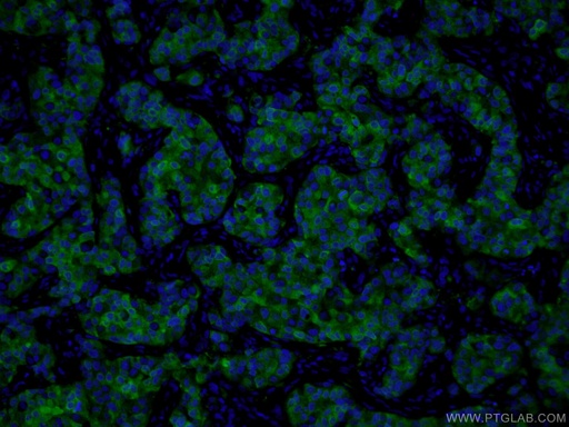 [66386-1-IG-20UL] PADI2 Monoclonal antibody