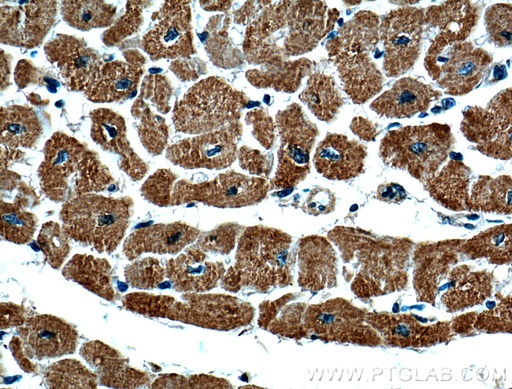 [66388-1-IG-20UL] VDAC2 Monoclonal antibody