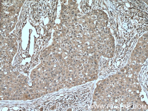 [66392-1-IG-20UL] VPRBP Monoclonal antibody