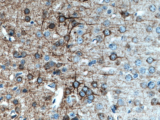 [66396-1-IG-20UL] NF-M Monoclonal antibody