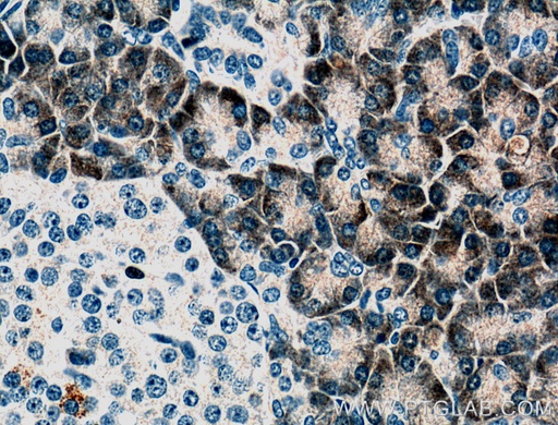[66397-1-IG-20UL] PLA2G1B Monoclonal antibody