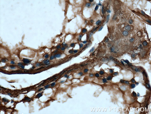 [66398-1-IG-20UL] VTN Monoclonal antibody