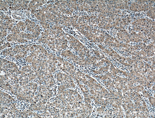 [66399-1-IG-150UL] Plasminogen Monoclonal antibody
