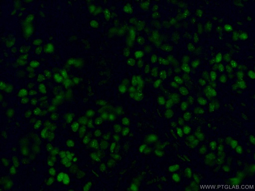 [66400-1-IG-20UL] GATA3 Monoclonal antibody