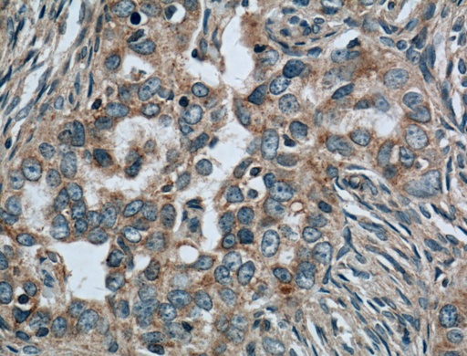 [66401-1-IG-150UL] CALCOCO2 Monoclonal antibody